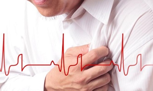 Nguyên nhân gây thiếu máu cơ tim và cách hỗ trợ điều trị tại nhà
