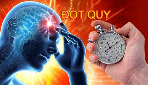 xuất huyết não là nguyên nhân dẫn đến đột quỵ, thậm chí tử vong