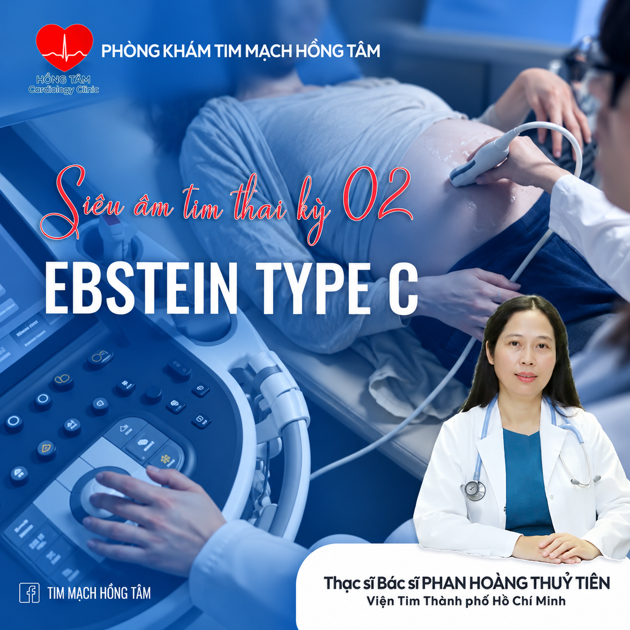SIÊU ÂM TIM THAI KỲ 02 – EBSTEIN TYPE C