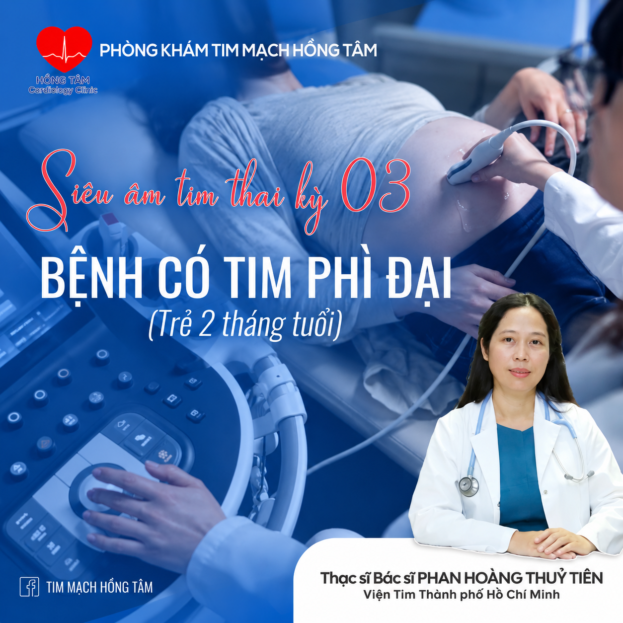 SIÊU ÂM TIM KỲ 03 – BỆNH CƠ TIM PHÌ ĐẠI (Trẻ 2 tháng tuổi)